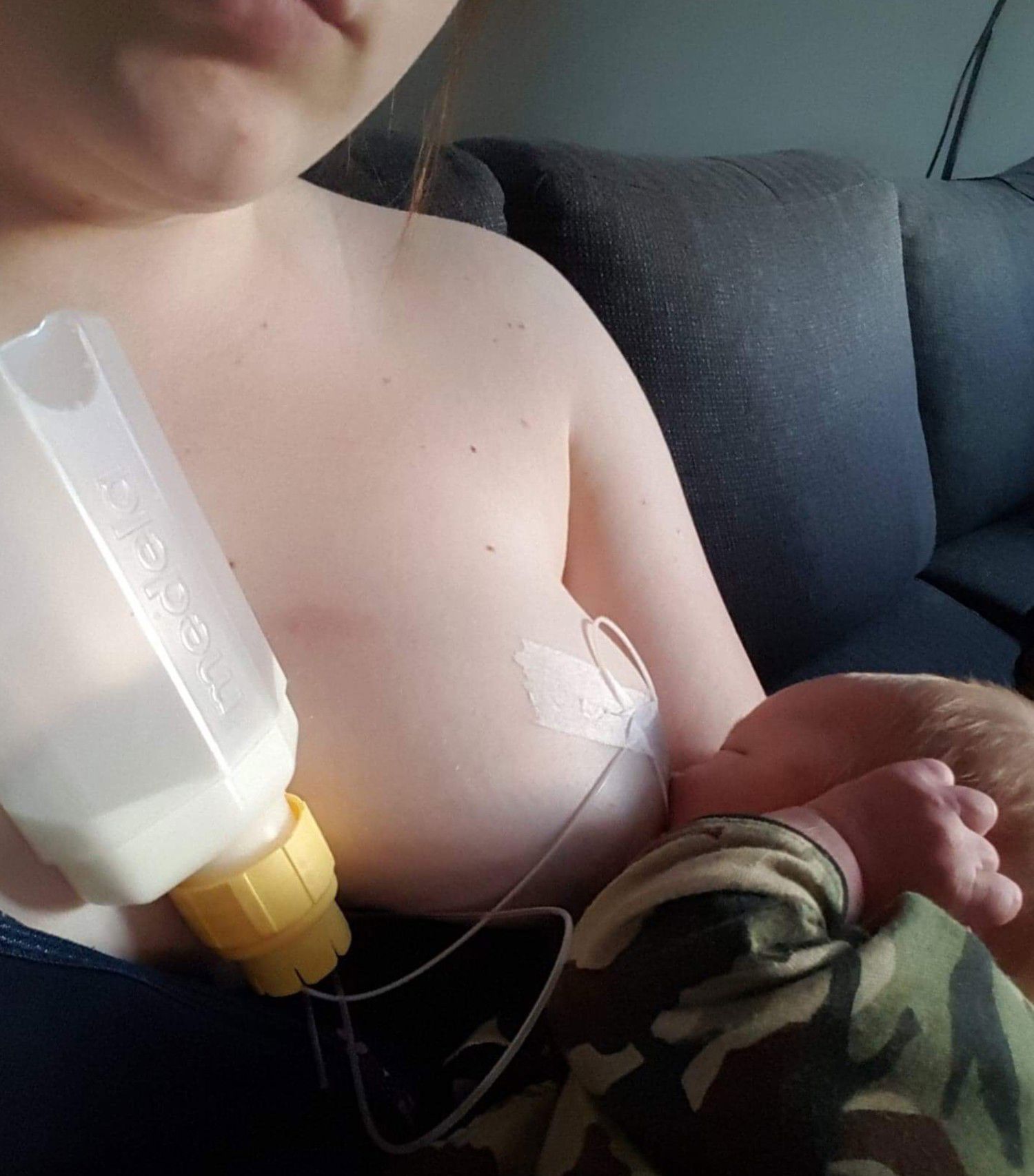 Barn der ammes og suppleres ved hjælp af ammesugerør