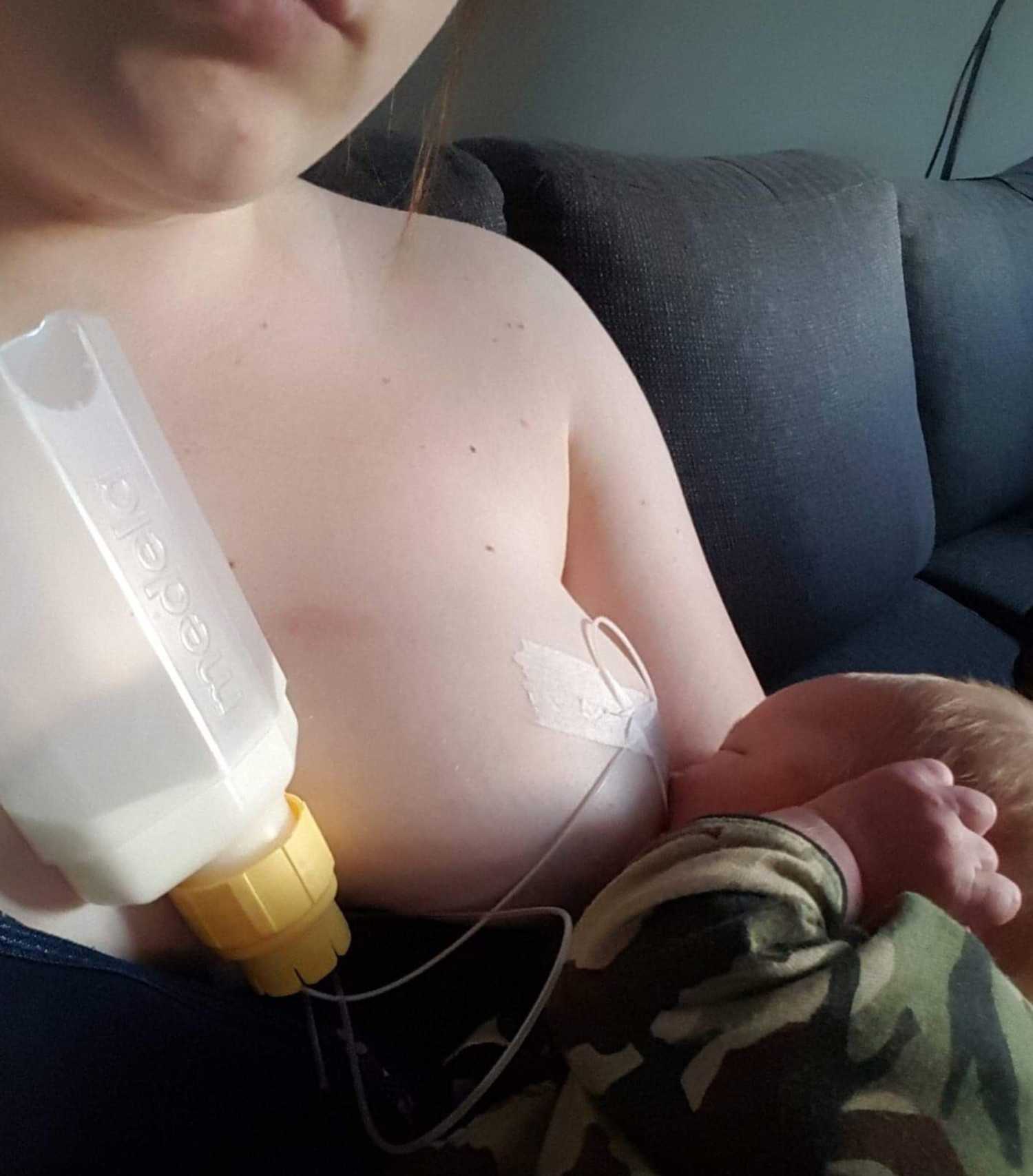 Barn der ammes og suppleres ved hjælp af ammesugerør